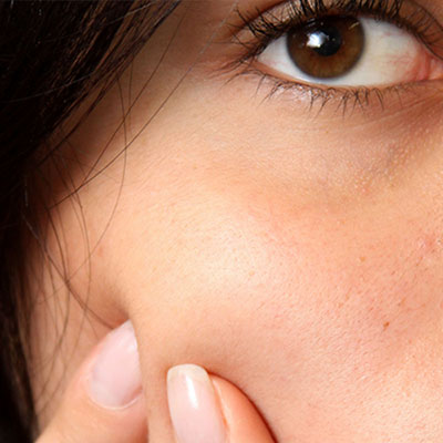 Acne / Congested – Boheme Skin + Beauty